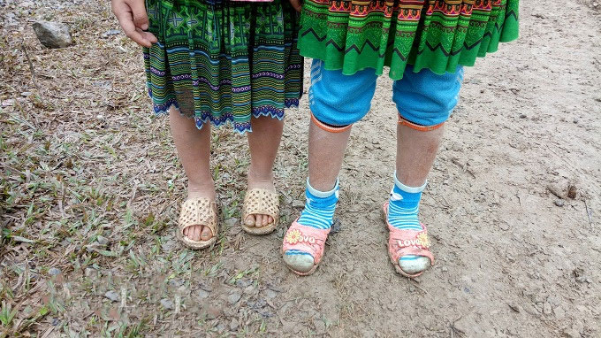 Rét đậm ở miền Bắc: Trẻ em vùng cao chân trần co ro trong giá buốt